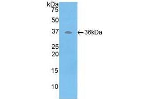 Western blot analysis of recombinant Human ATP6AP2. (ATP6AP2 anticorps  (AA 17-302))
