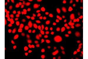 Immunofluorescence analysis of A549 cells using IFRD1 antibody. (IFRD1 anticorps)