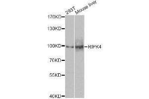 Western blot analysis of extracts of various cell lines, using RIPK4 antibody. (RIPK4 anticorps  (AA 240-520))