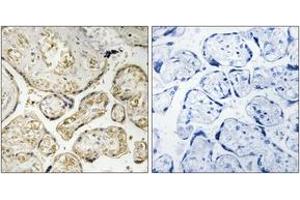 Immunohistochemistry analysis of paraffin-embedded human placenta tissue, using APOBEC3D/F Antibody. (APOBEC3D/F (AA 232-281) anticorps)