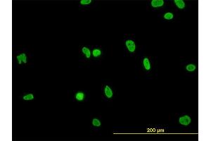 Immunofluorescence of monoclonal antibody to HNRNPG-T on HeLa cell. (RBMXL2 anticorps  (AA 1-90))