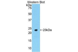 Western Blotting (WB) image for anti-Peroxisome Proliferator-Activated Receptor gamma (PPARG) (AA 311-493) antibody (ABIN1860283) (PPARG anticorps  (AA 311-493))