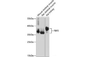 Western blot analysis of extracts of various cell lines using FBP2 Polyclonal Antibody at dilution of 1:1000. (FBP2 anticorps)