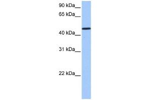 SAMD14 antibody used at 1 ug/ml to detect target protein. (SAMD14 anticorps  (N-Term))