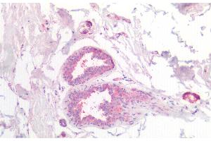 Detection of CSN2 in Human Breast Tissue using Polyclonal Antibody to Casein Beta (CSN2) (CSN2 anticorps  (AA 41-198))