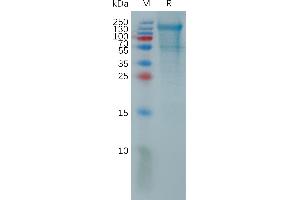 Human P Protein, His Tag on SDS-PAGE under reducing condition.