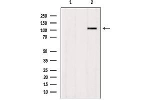 Western blot analysis of extracts from HepG2, using ZNF295 Antibody. (ZNF295 anticorps  (N-Term))
