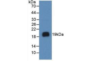 Western blot analysis of recombinant Human VEGFA.