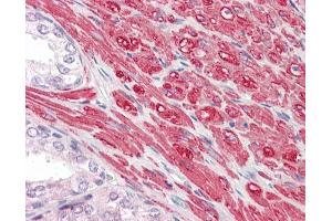 Anti-GREM2 / Gremlin 2 antibody IHC staining of human prostate. (GREM2 anticorps  (AA 107-168))