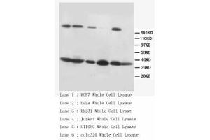 Image no. 2 for anti-Fas Ligand (TNF Superfamily, Member 6) (FASL) (C-Term) antibody (ABIN1492926) (FASL anticorps  (C-Term))