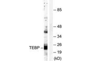 Western blot analysis of extracts from NIH-3T3 cells, treated with EGF 200ng/ml 30', using TEBP (Ab-113) Antibody.