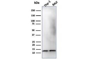 Western Blot Analysis of THP-1 and Raji Cell lysate using Beta-2-Microglobulin Mouse Monoclonal Antibody (B2M/1118). (beta-2 Microglobulin anticorps)
