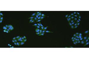 Immunofluorescence analysIs of HepG2 cell using SLC18A3 Polyclonal Antibody at dilution of 1:50 (SLC18A3 anticorps)