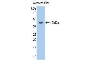 Western Blotting (WB) image for anti-Keratin 16 (KRT16) (AA 117-419) antibody (ABIN1172993) (KRT16 anticorps  (AA 117-419))