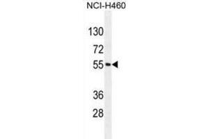 Western Blotting (WB) image for anti-Mesoderm Induction Early Response 1, Family Member 2 (MIER2) antibody (ABIN2996066) (MIER2 anticorps)