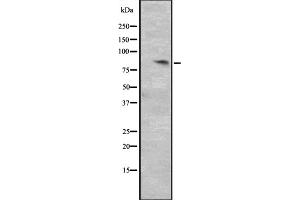 Western blot analysis of CCNT2 expression in HepG2 whole cell lysate ,The lane on the left is treated with the antigen-specific peptide. (Cyclin T2 anticorps  (Internal Region))