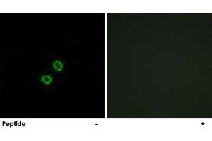 Immunofluorescence analysis of A-549 cells, using KIR2DL5B polyclonal antibody . (KIR2DL5B anticorps)