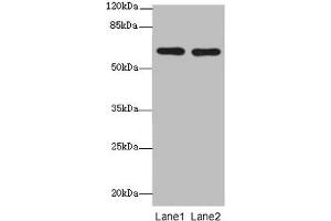 Western blot All lanes: CNOT2 antibody at 2 μg/mL Lane 1: 293T whole cell lysate Lane 2: Jurkat whole cell lysate Secondary Goat polyclonal to rabbit IgG at 1/10000 dilution Predicted band size: 60, 41, 23, 52, 55 kDa Observed band size: 60 kDa (CNOT2 anticorps  (AA 1-335))