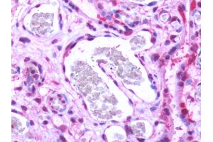 Human, Placenta: Formalin-Fixed Paraffin-Embedded (FFPE) (S1PR1 anticorps  (Cytoplasmic Domain))