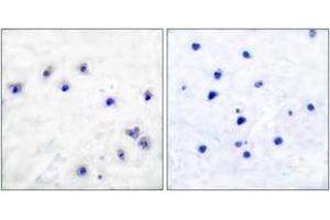 Immunohistochemistry analysis of paraffin-embedded human brain, using Tyrosine Hydroxylase (Phospho-Ser19) Antibody. (Tyrosine Hydroxylase anticorps  (pSer18))