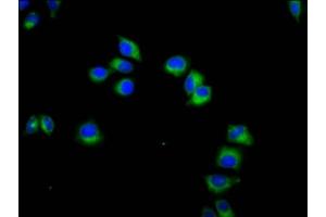 Immunofluorescence staining of Hela cells with ABIN7161649 at 1:133, counter-stained with DAPI.