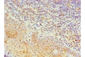 Immunohistochemistry of paraffin-embedded human tonsil tissue using ABIN7161993 at dilution of 1: 100 (TIA1 anticorps  (AA 1-193))