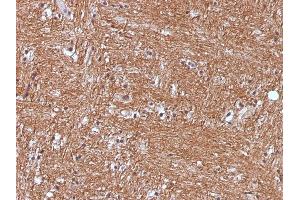 Formalin-fixed, paraffin-embedded human Cerebellum stained with NSE gamma Monoclonal Antibody (ENO2/1375). (ENO2/NSE anticorps  (AA 416-433))