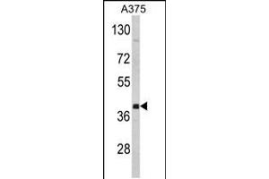 Western blot analysis of hFNTA-A345 in A375 cell line lysates (35ug/lane)