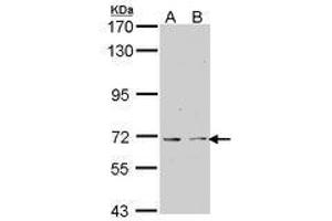 Image no. 1 for anti-K(lysine) Acetyltransferase 5 (KAT5) (AA 230-462) antibody (ABIN467563)