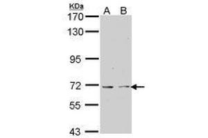 Image no. 1 for anti-K(lysine) Acetyltransferase 5 (KAT5) (AA 230-462) antibody (ABIN467563) (KAT5 anticorps  (AA 230-462))