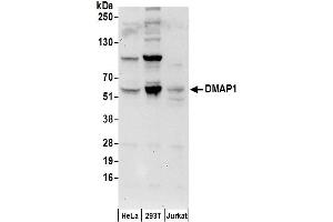 Western Blotting (WB) image for anti-DNA Methyltransferase 1-Associated Protein 1 (DMAP1) (AA 400-450) antibody (ABIN7449182)
