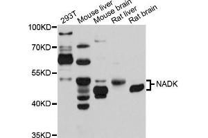 Western blot analysis of extracts of various cells, using NADK antibody.
