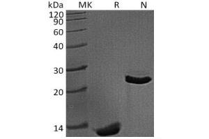 Western Blotting (WB) image for Transforming Growth Factor, beta 1 (TGFB1) (Active) protein (ABIN7320668) (TGFB1 Protéine)