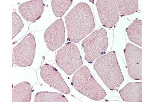 Human, Skeletal muscle: Formalin-Fixed Paraffin-Embedded (FFPE). (TFAP2B anticorps  (N-Term))