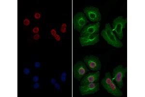 ABIN6258036 and ABIN6274198 staining Hela by IF/ICC.