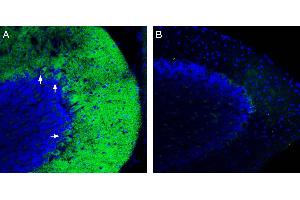 Expression of ZIP14 in mouse cerebellum. (Solute Carrier Family 39 (Zinc Transporter), Member 14 (SLC39A14) Peptide)