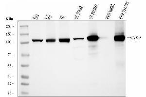 Western blot analysis of SND1 using anti-SND1 antibody (ABIN7600525). (SND1 anticorps  (AA 20-204))