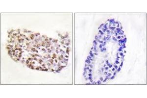 Immunohistochemistry analysis of paraffin-embedded human thyroid gland tissue, using NFAT5 (Ab-1197) Antibody. (NFAT5 anticorps  (AA 1171-1220))