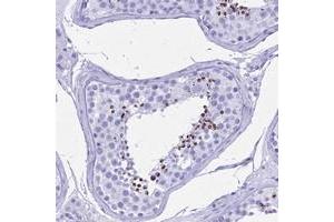 Immunohistochemical staining of human testis with PATE4 polyclonal antibody  shows strong cytoplasmic positivity in cells in seminiferus ducts at 1:50-1:200 dilution. (PATE4 anticorps)