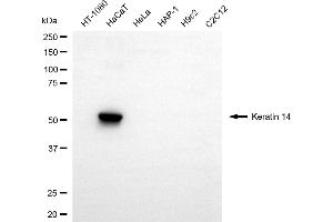 Western blotting analysis using keratin 14 antibody (ABIN7799167).