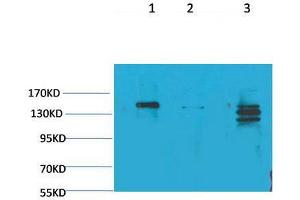 Western Blot (WB) analysis of 1) Rat Brain Tissue, 2)Mouse Brain Tissue, 3) HeLa with SLC12A4 Rabbit Polyclonal Antibody diluted at 1:2000.