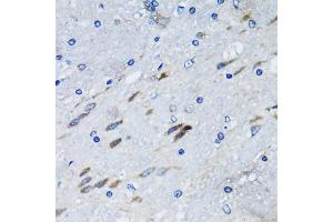 Immunohistochemistry of paraffin-embedded mouse brain using BLZF1 antibody (ABIN2561429) at dilution of 1:100 (40x lens). (BLZF1 anticorps)