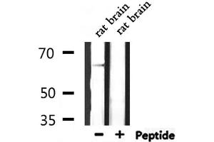 Western blot analysis of extracts from rat brain, using SLC6A1 Antibody. (SLC6A1 anticorps  (Internal Region))