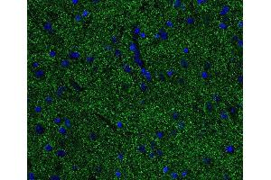 Indirect immunostaining of PFA fixed paraffin embedded mouse spinal cord section (dilution 1 : 500; green). (Alpha, beta Synuclein anticorps)
