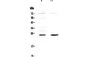 Western blot analysis of IL6 using anti-IL6 antibody . (IL-6 anticorps)