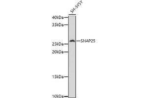 Western blot analysis of extracts of SH-SY5Y cells, using SN antibody (ABIN3021231, ABIN3021232, ABIN3021233 and ABIN6214078) at 1:1000 dilution. (SNAP25 anticorps  (AA 1-206))