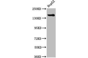 Western Blot Positive WB detected in: HepG2 whole cell lysate All lanes: CPS1 antibody at 3. (CPS1 anticorps  (AA 1361-1500))