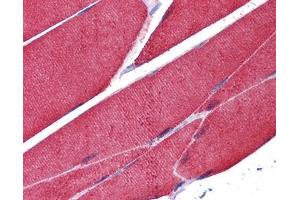 IHC-P Image Immunohistochemical analysis of paraffin-embedded human skeletal muscle, using alpha Actin (skeletal muscle), antibody(10 μg/ml).