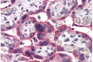 Anti-SLC5A6 antibody  ABIN1049347 IHC staining of human placenta.