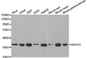 Western blot analysis of extracts of various cell lines, using AKR1B1 antibody. (AKR1B1 anticorps  (AA 1-316))